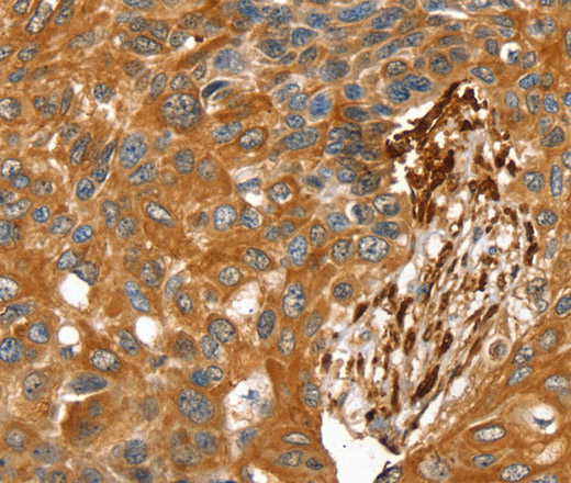 TAGLN Polyclonal Antibody (E-AB-11588)