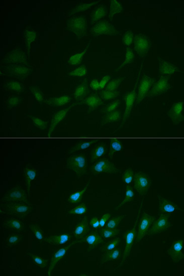 LIG1 Polyclonal Antibody (E-AB-60480)