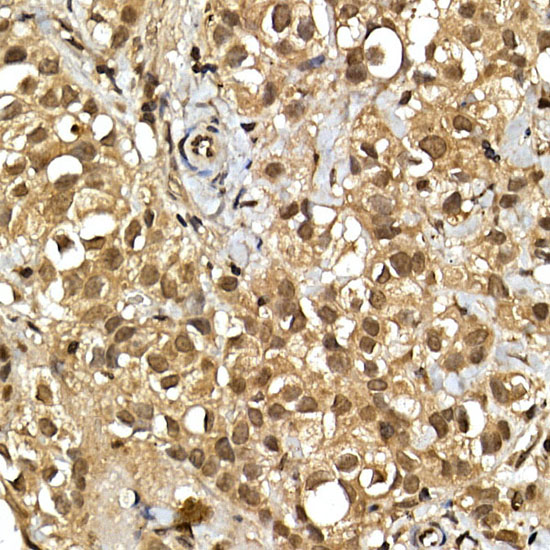 SQSTM1 / p62 Polyclonal Antibody (E-AB-68411)