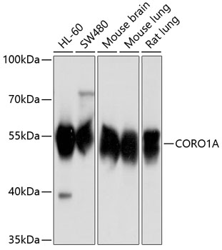 CORO1A Polyclonal Antibody (E-AB-68427)