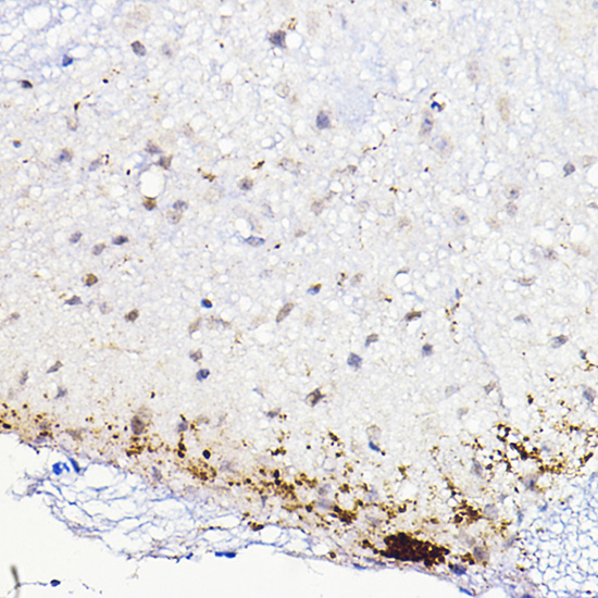 CALCA Polyclonal Antibody (E-AB-93168)