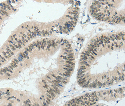 HNF1B Polyclonal Antibody (E-AB-12661)