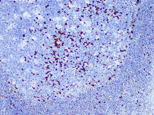 MUM1 Monoclonal Antibody (ELAB6936-M)