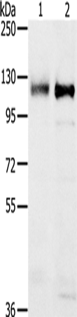 PTPN12 Polyclonal Antibody (E-AB-13541)