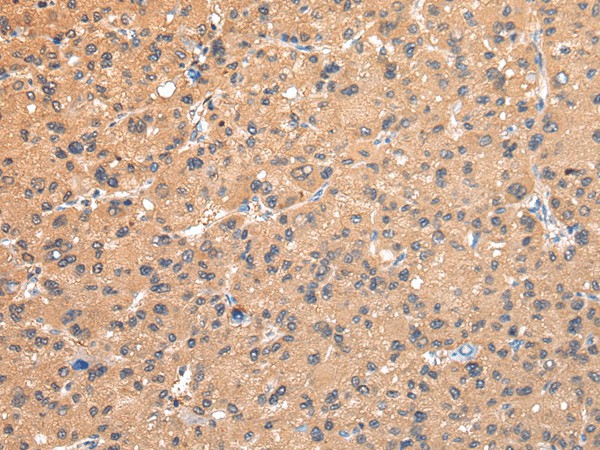 AP2A1 Polyclonal Antibody (E-AB-17662)