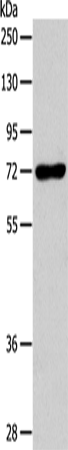CD218b Polyclonal Antibody (E-AB-10677)