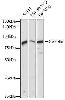 Gelsolin Polyclonal Antibody (E-AB-91640)