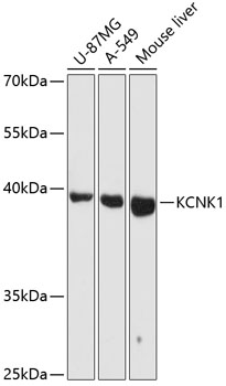 KCNK1 Polyclonal Antibody (E-AB-65969)