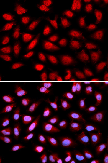 PPP2R4 Polyclonal Antibody (E-AB-60498)