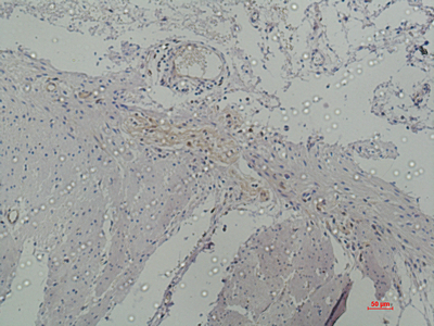 Galectin 3 Monoclonal Antibody (E-AB-22188)