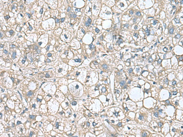 RHBDL2 Polyclonal Antibody (E-AB-19107)
