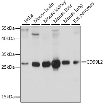 CD99L2 Polyclonal Antibody (E-AB-91342)