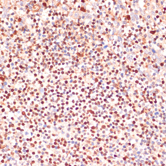 ALOX5 Polyclonal Antibody (E-AB-67417)