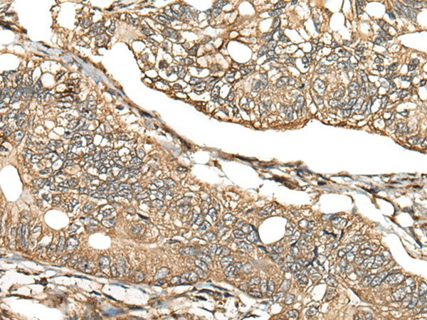 CA11 Polyclonal Antibody (E-AB-52516)