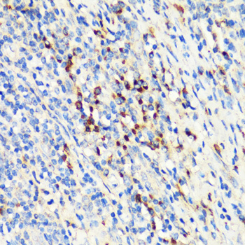 TNFSF11 Polyclonal Antibody (E-AB-67022)