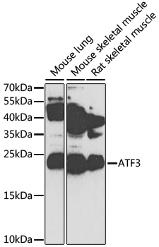 ATF3 Polyclonal Antibody (E-AB-93239)