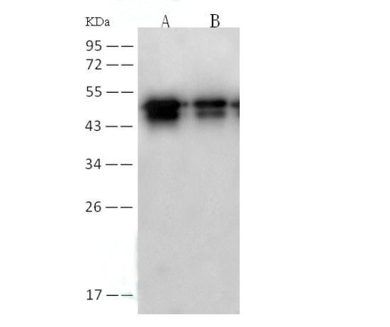 Anti-SARS-CoV Nucleoprotein / NP Monolonal Antibody (E-AB-V1341)