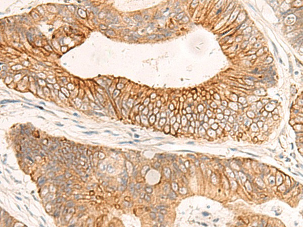 ABHD2 Polyclonal Antibody (E-AB-53414)