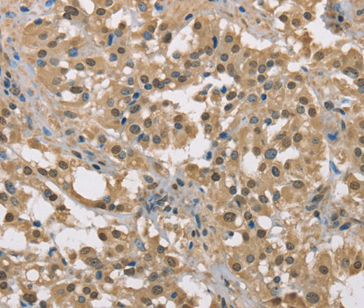 DACH2 Polyclonal Antibody (E-AB-11136)