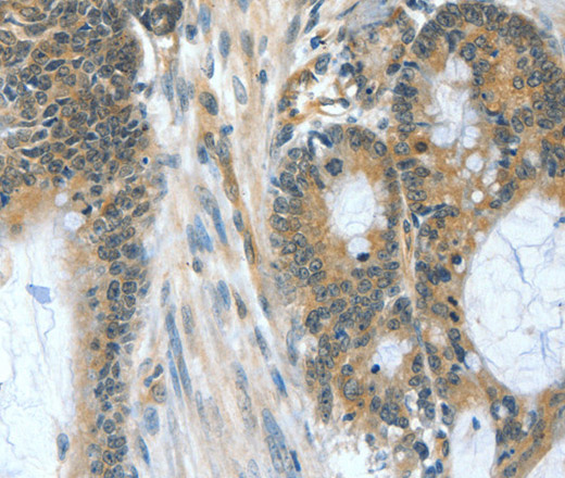 BAD Polyclonal Antibody (E-AB-13813)