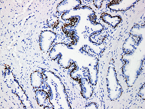 p63 Monoclonal Antibody (ELAB6082-M)