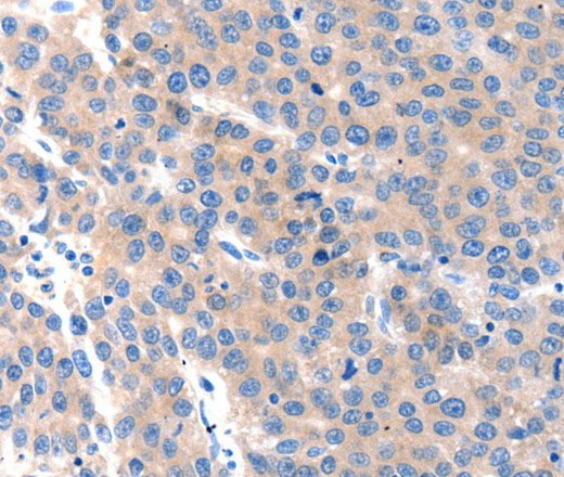 KLK2 Polyclonal Antibody (E-AB-15739)