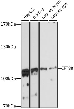 IFT88 Polyclonal Antibody (E-AB-65998)