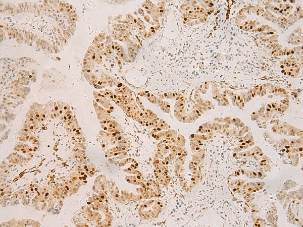 RFX6 Polyclonal Antibody (E-AB-18867)