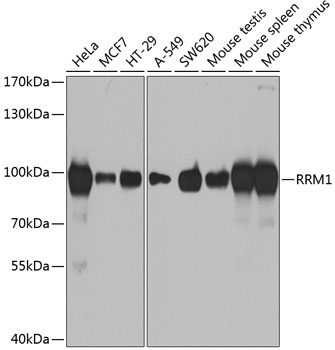 RRM1 Polyclonal Antibody (E-AB-60214)