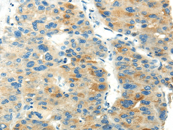 PDPN Polyclonal Antibody (E-AB-17607)