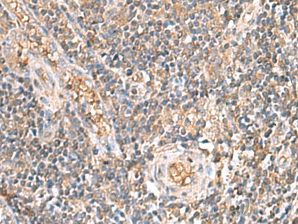 ARF5 Polyclonal Antibody (E-AB-19477)
