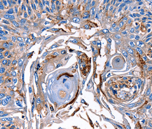 LRP2 Polyclonal Antibody (E-AB-12482)