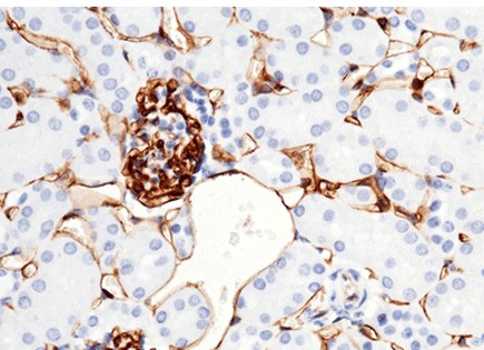 Recombinant CD38 Monoclonal Antibody (AN300490P)