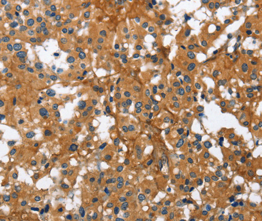 BGN Polyclonal Antibody (E-AB-11001)