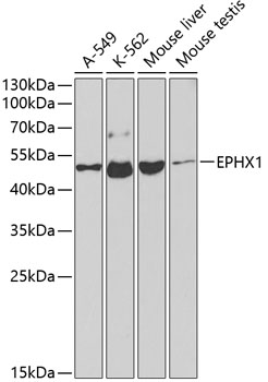 EPHX1 Polyclonal Antibody (E-AB-60588)