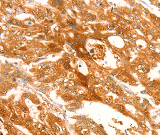 TRPM7 Polyclonal Antibody (E-AB-16103)