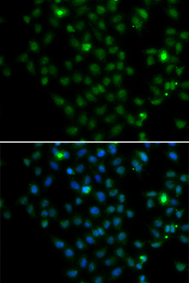 LMO4 Polyclonal Antibody (E-AB-61607)