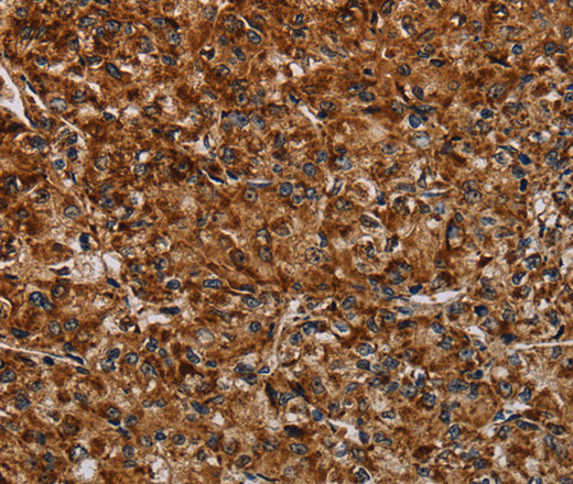 NDUFAB1 Polyclonal Antibody (E-AB-16634)