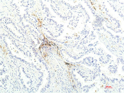 JAK1 Monoclonal Antibody (E-AB-22202)