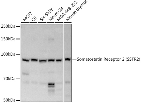 SSTR2 Polyclonal Antibody (E-AB-68360)