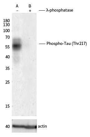 Recombinant Phospho-Tau (Thr217) Monoclonal Antibody (AN300377L)