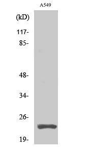 Cleaved-PARP1 (D214) Polyclonal Antibody (E-AB-30080)