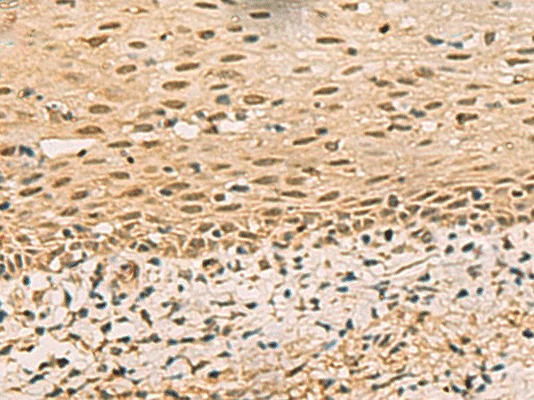 FOXH1 Polyclonal Antibody (E-AB-19880)