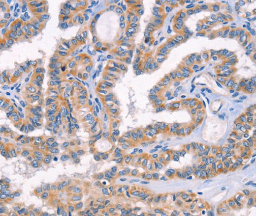 AP1B1 Polyclonal Antibody (E-AB-16161)