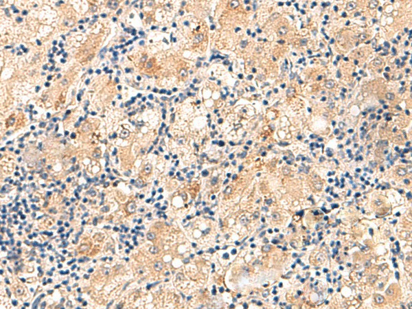 MRPL16 Polyclonal Antibody (E-AB-52866)