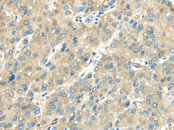 VPS4A Polyclonal Antibody (E-AB-17555)