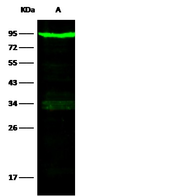 Recombinant Transferrin Receptor/TFRC/CD71 Monoclonal Antibody (AN300360P)