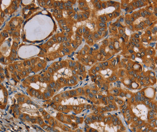CENPU Polyclonal Antibody (E-AB-11402)