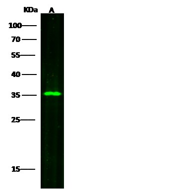 SULT2A1/STD Monoclonal Antibody (AN200067P)