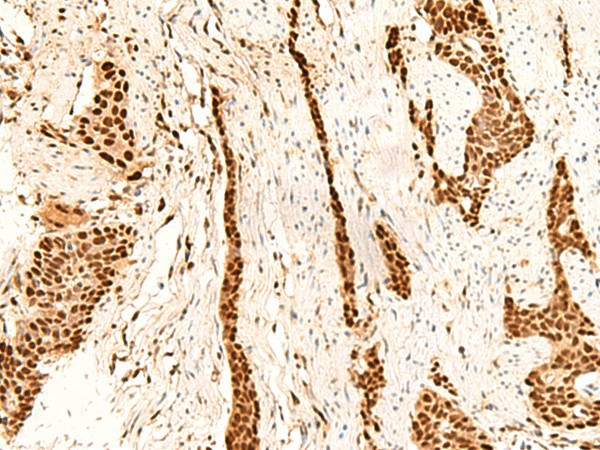 METTL1 Polyclonal Antibody (E-AB-52870)